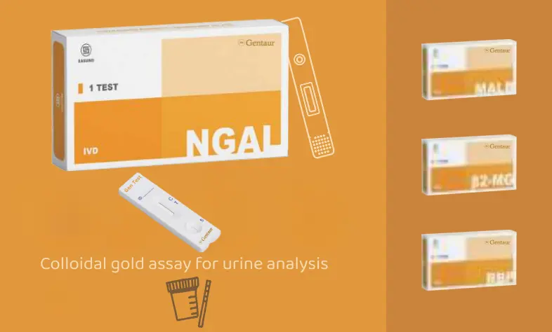 [WS] Urinalysis Test Kits for Renal Disease